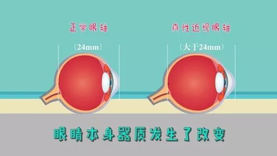 玩什么游戏对眼睛有好处_玩手游对眼睛的伤害_手机玩游戏是不是对眼睛好