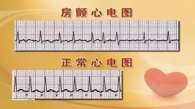 操控类手游_手机游戏操控感_操控的游戏